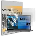 3 PCS Dell Latitude 14 Anti Glare Screen Protector for 14" Dell Latitude 14 7430 7420 7410 5431 5430 5421 5420 E5490 E5491 E6440 E7450 E7470 E7480 E7440 5480 7490 5490 5400 7480 7400,Anti Fingerprint