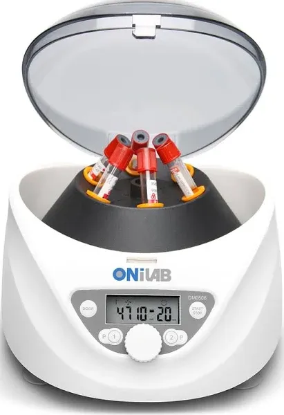 ONiLAB Lab PRP Benchtop Centrifuge 6x15ml10ml7ml1.5-5ml 300-5000rp